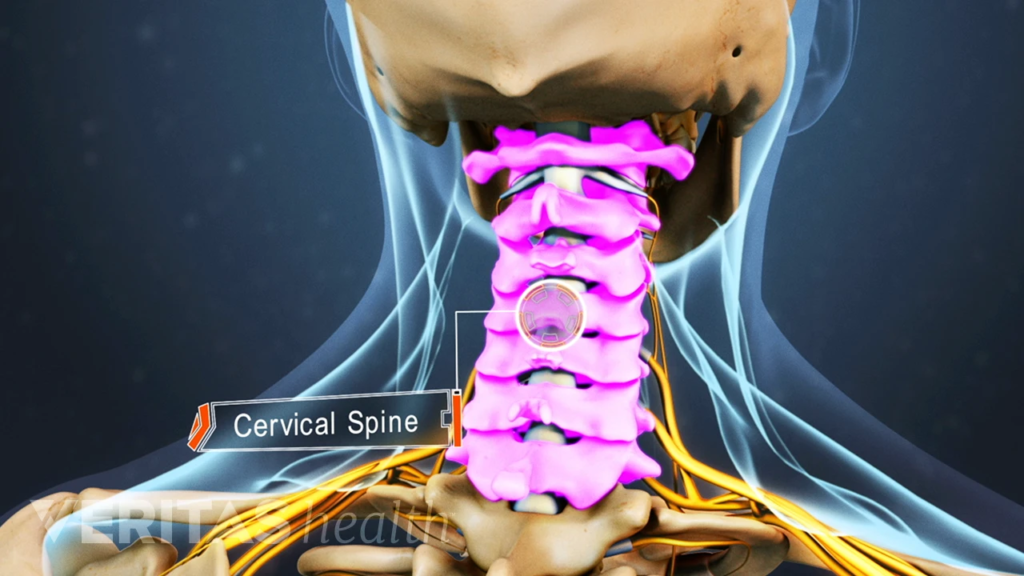 cervical spine and cervicobrachialgia