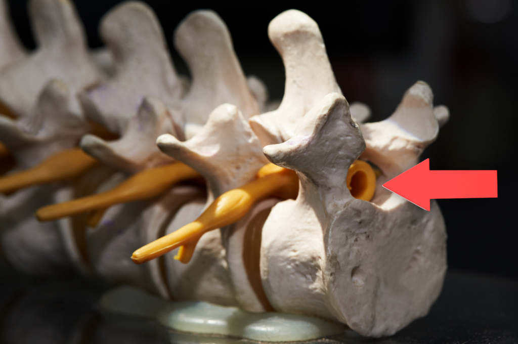 Lumbar canal and vertebrae